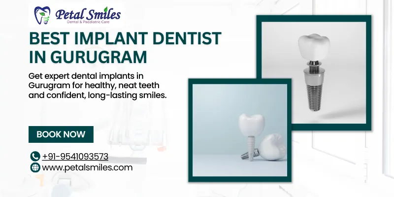 Best implant dentist in Gurugram