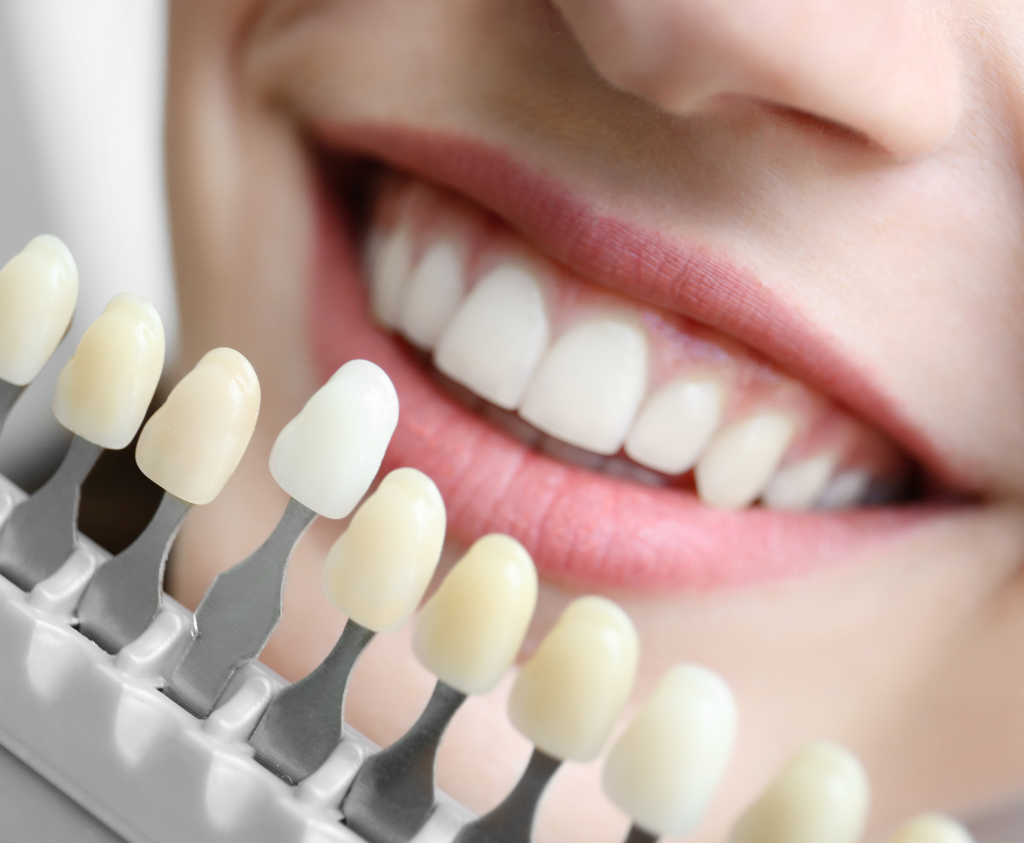 "Zoom Teeth Whitening