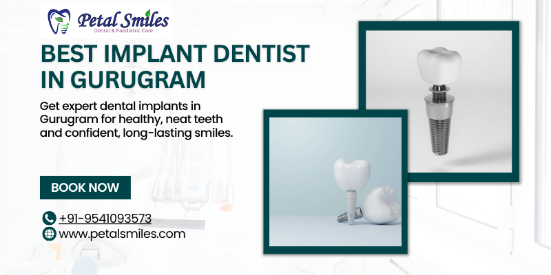 Best implant dentist in Gurugram