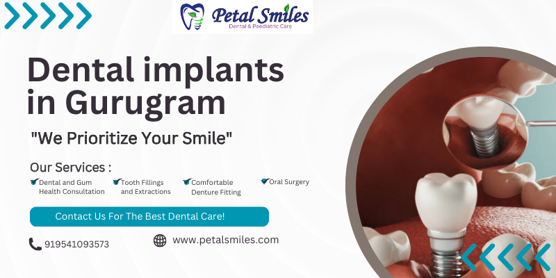 Dental implants in Gurugram (1)