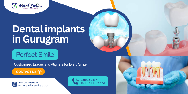 Dental implants in Gurugram