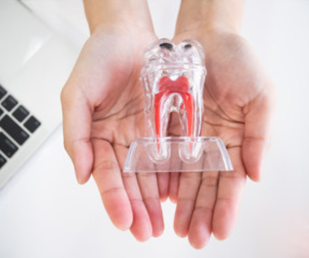Painless Root Canal Treatment