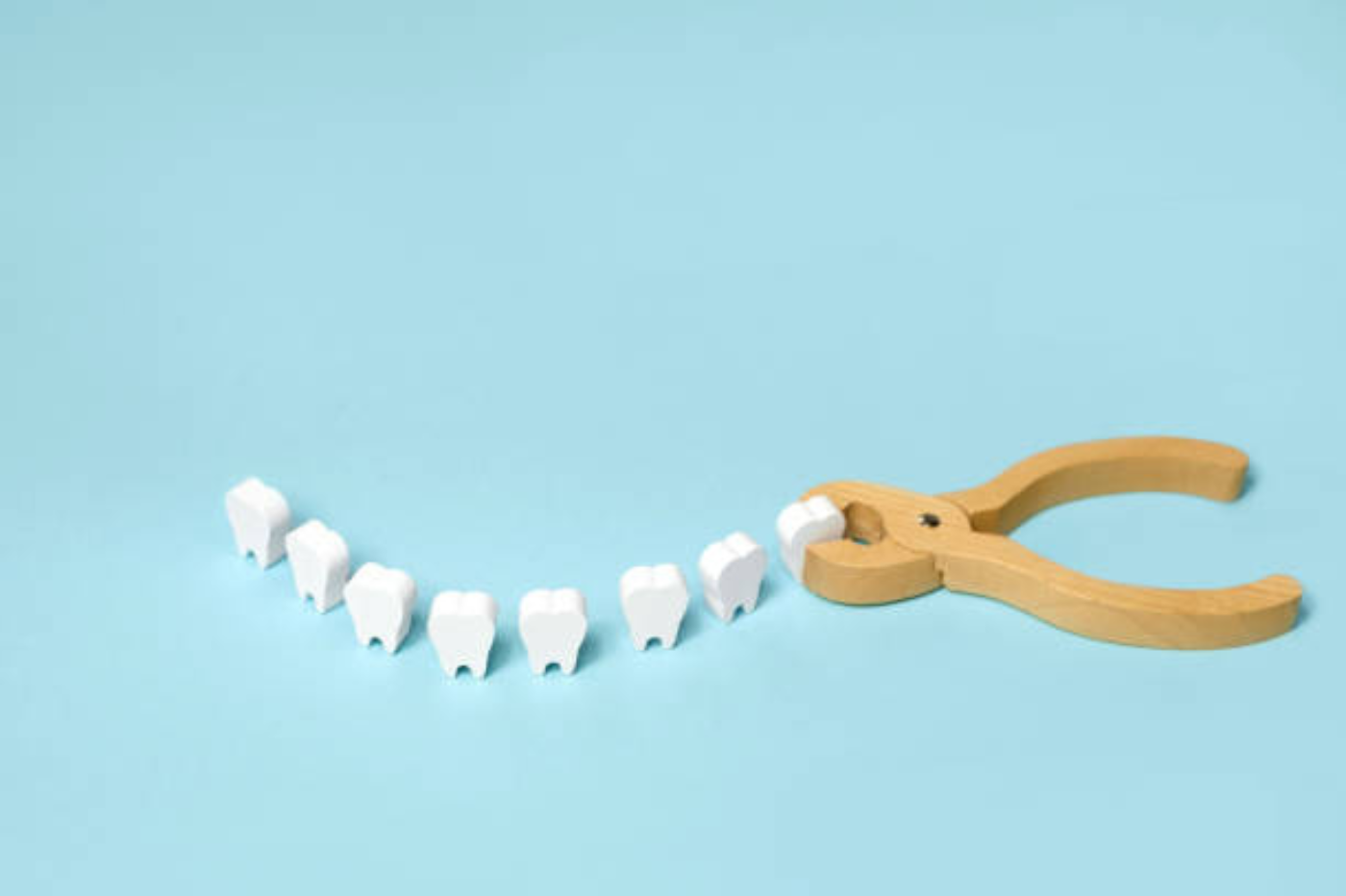 Wisdom Tooth Extraction