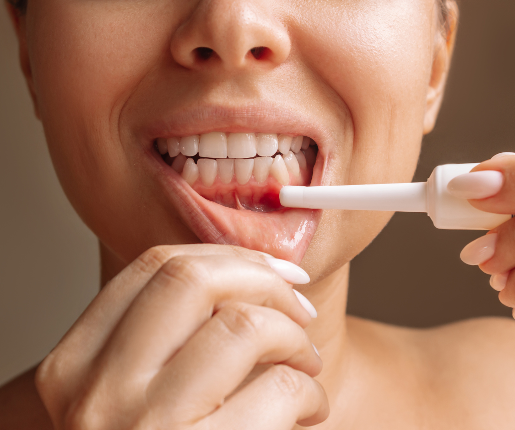Gum Surgery