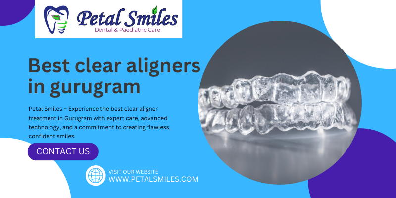 Best clear aligners in gurugram (1)