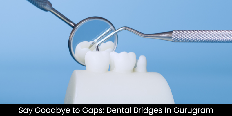 Dental Bridges treatment at Petal Smiles, Gurugram restoring missing teeth naturally