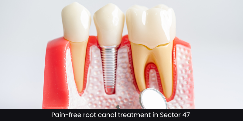 Emergency tooth extraction by Dr. Adish Chaudhary at Petal Smiles, Sector 46 Gurugram