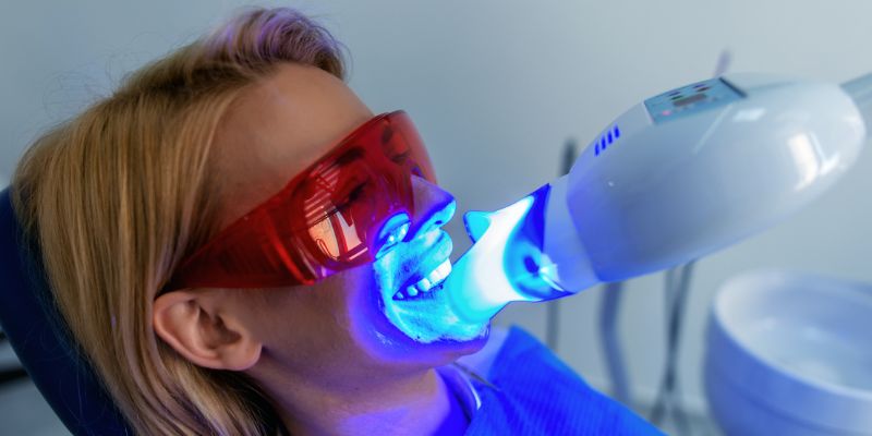 Zoom whitening treatment in Wembley Estate by Dr. Adish Chaudhary at Petal Smiles Dental Clinic