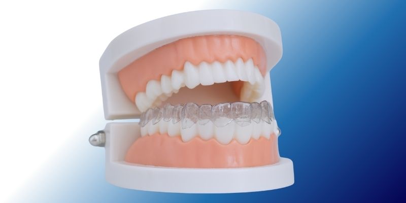 Affordable orthodontic treatment near South City 2 at Petal Smiles Dental Clinic