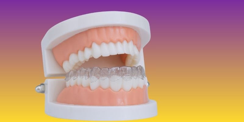 Teeth alignment treatment near Nirvana Country at Petal Smiles Dental Clinic