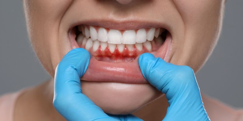 Best sensitive teeth treatment near Badshahpur by Dr. Adish Chaudhary at Petal Smiles Dental Clinic