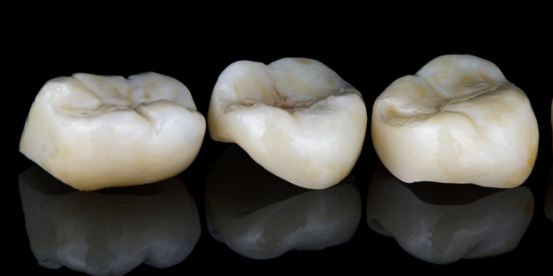 Best dental crown specialist in Sushant Lok 3 at Petal Smiles Dental Clinic performing precise and pain-free crown treatment by Dr. Adish Chaudhary.