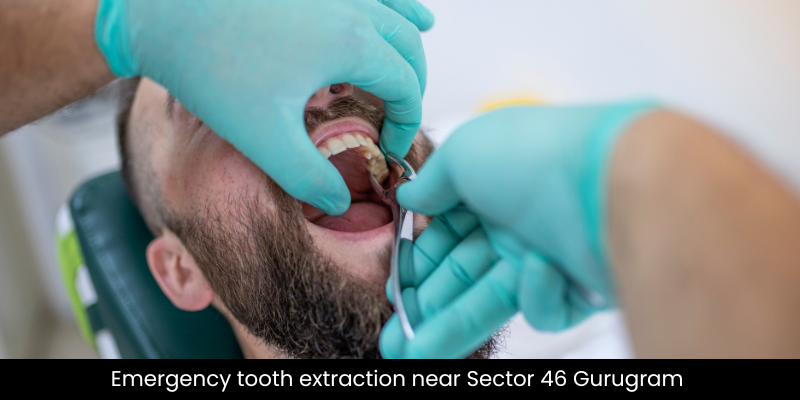 Emergency tooth extraction at Petal Smiles, Sector 46 Gurugram