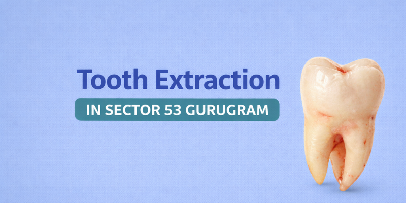 Painless tooth extraction at Petal Smiles Dental Clinic in Sector 53 Gurugram