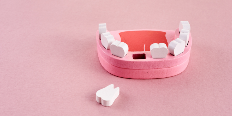 Tooth extraction in Sector 48 Gurugram performed by Dr. Adish Chaudhary at Petal Smiles Dental Clinic