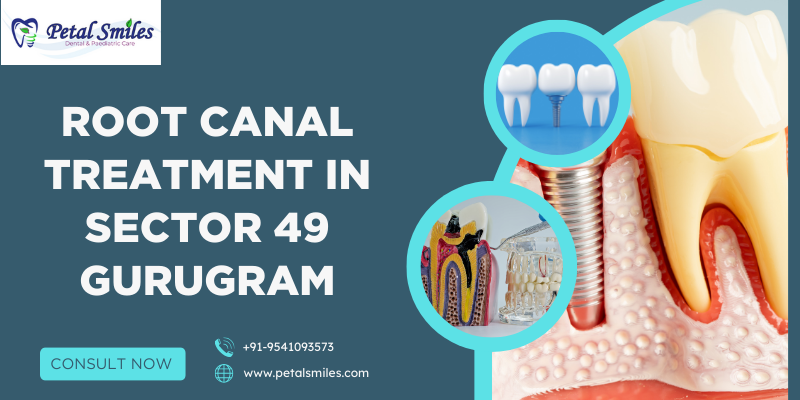 Root canal treatment in Sector 49 Gurugram at Petal Smiles using advanced painless dental technology