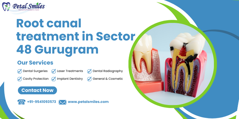 Root canal treatment in Sector 48 Gurugram performed by expert dentist at Petal Smiles Dental Clinic