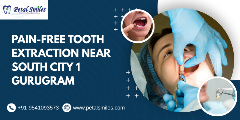 Pain-free tooth extraction near South City 1 Gurugram at Petal Smiles Dental Clinic