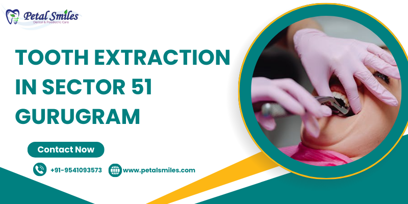 Tooth extraction in Sector 51 Gurugram at Petal Smiles by Dr. Adish Chaudhary using painless dental techniques
