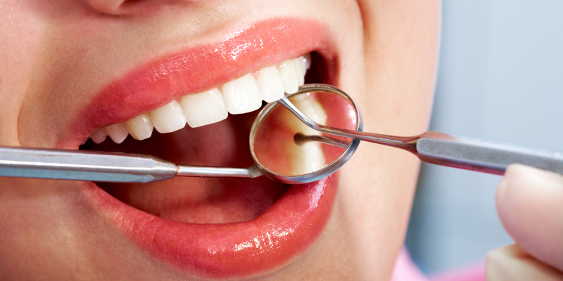 Dental checkup in Gurugram at Petal Smiles Dental Clinic