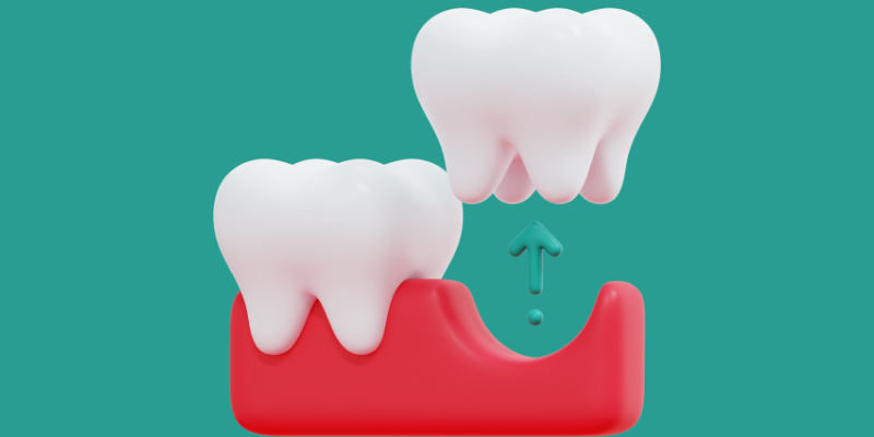 Is tooth extraction painful in Gurgaon at Petal Smiles Dental with advanced pain-free treatment