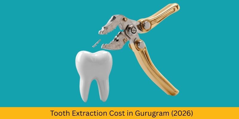 Tooth extraction treatment at Petal Smiles Dental Clinic Gurugram