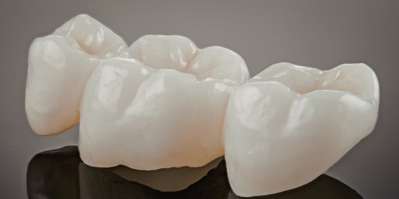 Zirconia crown in Gurgaon at Petal Smiles dental clinic