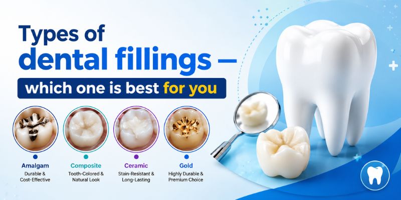 Comparison of different types of dental fillings including amalgam, composite, ceramic, and gold fillings with a dental tooth model and informative guide.