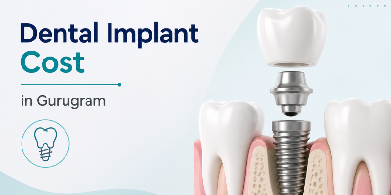Dental implant treatment and cost consultation in Gurugram.